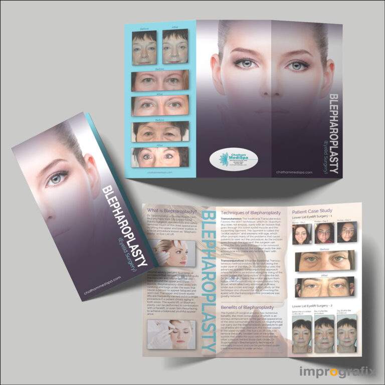 Tri-fold Brochure Design and Print for CMS